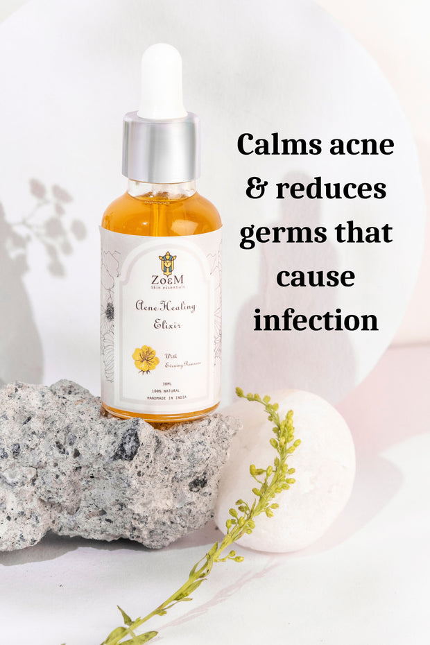 ZoeM Acne healing elixir